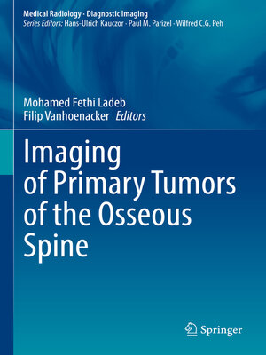 cover image of Imaging of Primary Tumors of the Osseous Spine